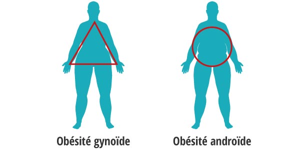 Schema obesite